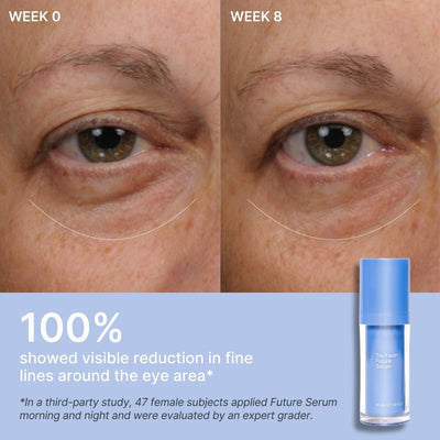 SPIRIT_beauty_excellence_Nu Skin_Skincare_Beauty_Wellness_Tru Face_ageLOC Future Serum_Clinical Results Eye Area