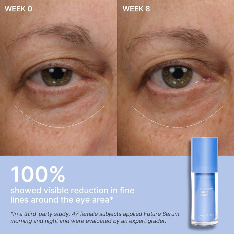 SPIRIT_beauty_excellence_Nu Skin_Skincare_Beauty_Wellness_Tru Face_ageLOC Future Serum_Clinical Results Eye Area