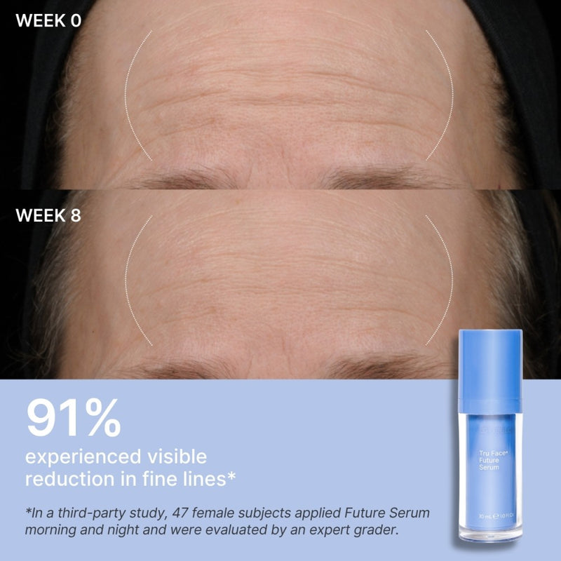 SPIRIT_beauty_excellence_Nu Skin_Skincare_Beauty_Wellness_Tru Face_ageLOC Future Serum_Clinical Results Forehead